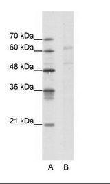 CACNB3 / Cavbeta3 Antibody - A: Marker, B: Jurkat Cell Lysate.  This image was taken for the unconjugated form of this product. Other forms have not been tested.