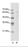 CACNB3 / Cavbeta3 Antibody - A: Marker, B: Jurkat Cell Lysate.  This image was taken for the unconjugated form of this product. Other forms have not been tested.