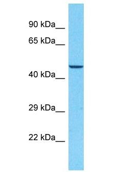 CACNB3 / Cavbeta3 Antibody - CACNB3 / Cavbeta3 antibody Western Blot of HeLa. Antibody dilution: 1 ug/ml.  This image was taken for the unconjugated form of this product. Other forms have not been tested.