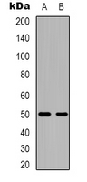 CACNB3 / Cavbeta3 Antibody - Western blot analysis of CACNB3 expression in mouse brain (A); rat brain (B) whole cell lysates.