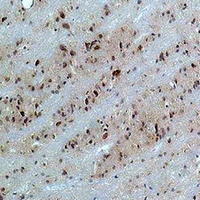 CACNB3 / Cavbeta3 Antibody - Immunohistochemical analysis of CACNB3 staining in rat brain formalin fixed paraffin embedded tissue section. The section was pre-treated using heat mediated antigen retrieval with sodium citrate buffer (pH 6.0). The section was then incubated with the antibody at room temperature and detected using an HRP conjugated compact polymer system. DAB was used as the chromogen. The section was then counterstained with hematoxylin and mounted with DPX.