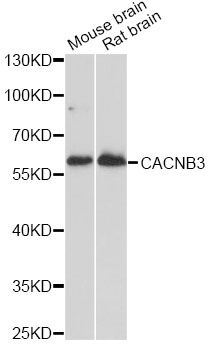 CACNB3 / Cavbeta3 Antibody - Western blot analysis of extracts of various cell lines, using CACNB3 antibody at 1:1000 dilution. The secondary antibody used was an HRP Goat Anti-Rabbit IgG (H+L) at 1:10000 dilution. Lysates were loaded 25ug per lane and 3% nonfat dry milk in TBST was used for blocking. An ECL Kit was used for detection and the exposure time was 90s.