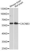CACNB3 / Cavbeta3 Antibody - Western blot analysis of extracts of various cell lines, using CACNB3 antibody at 1:1000 dilution. The secondary antibody used was an HRP Goat Anti-Rabbit IgG (H+L) at 1:10000 dilution. Lysates were loaded 25ug per lane and 3% nonfat dry milk in TBST was used for blocking. An ECL Kit was used for detection and the exposure time was 90s.
