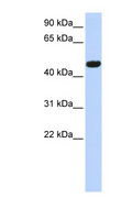 CACNB4 Antibody - CACNB4 antibody Western blot of MCF7 cell lysate. This image was taken for the unconjugated form of this product. Other forms have not been tested.