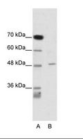 CACNB4 Antibody - A: Marker, B: Jurkat Cell Lysate.  This image was taken for the unconjugated form of this product. Other forms have not been tested.