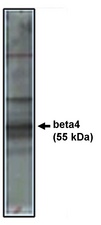 CACNB4 Antibody - Western blot of beta4 antibody on rat brain lysate