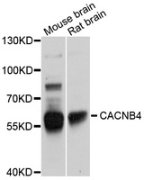 CACNB4 Antibody - Western blot analysis of extracts of various cells.