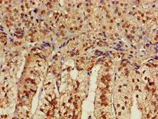 CACNB4 Antibody - Immunohistochemistry of paraffin-embedded human adrenal gland tissue using CACNB4 Antibody at dilution of 1:100