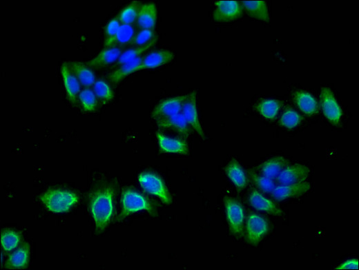CACNB4 Antibody - Immunofluorescent analysis of PC3 cells using CACNB4 Antibody at a dilution of 1:100 and Alexa Fluor 488-congugated AffiniPure Goat Anti-Rabbit IgG(H+L)