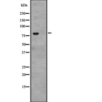 CACNB4 Antibody - Western blot analysis of CACNB4 expression in human Bone Marrow lysates in RIPA buffer. The lane on the left is treated with the antigen-specific peptide.