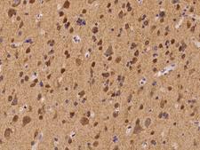 CACNB4 Antibody - Immunochemical staining of human CACNB4 in human brain with rabbit polyclonal antibody at 1:100 dilution, formalin-fixed paraffin embedded sections.