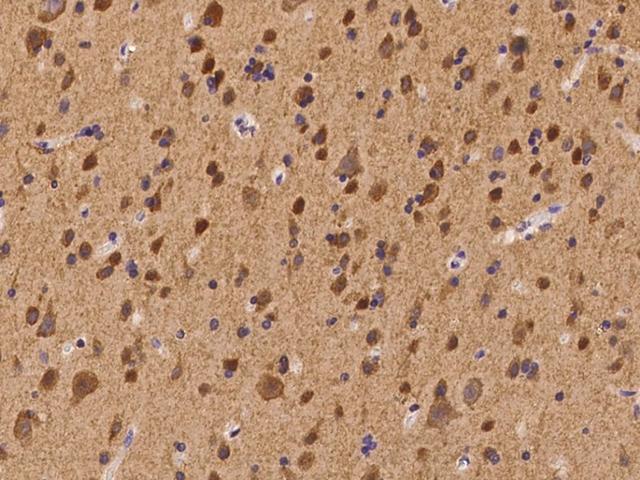 CACNB4 Antibody - Immunochemical staining of human CACNB4 in human brain with rabbit polyclonal antibody at 1:100 dilution, formalin-fixed paraffin embedded sections.