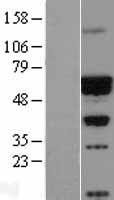 CACNB4 Protein - Western validation with an anti-DDK antibody * L: Control HEK293 lysate R: Over-expression lysate