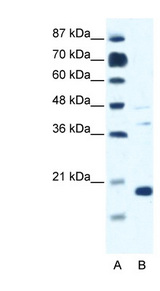 CACNG1 / CACNG Antibody - CACNG1 antibody Western blot of Jurkat lysate. This image was taken for the unconjugated form of this product. Other forms have not been tested.