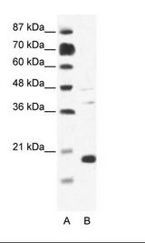 CACNG1 / CACNG Antibody - A: Marker, B: Jurkat Cell Lysate.  This image was taken for the unconjugated form of this product. Other forms have not been tested.