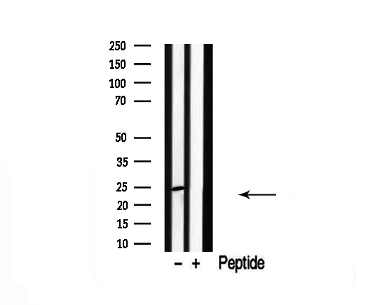 CACNG1 / CACNG Antibody - Western blot analysis of extracts of rat spleen lysate using CACNG1 antibody.