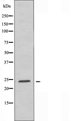 CACNG1 / CACNG Antibody - Western blot analysis of extracts of HeLa cells using CACNG1 antibody.