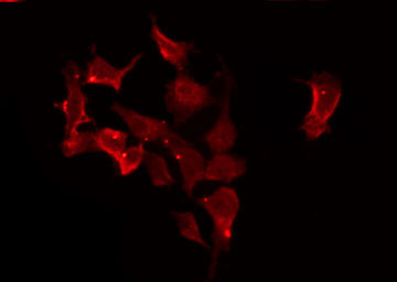 CACNG1 / CACNG Antibody - Staining HeLa cells by IF/ICC. The samples were fixed with PFA and permeabilized in 0.1% Triton X-100, then blocked in 10% serum for 45 min at 25°C. The primary antibody was diluted at 1:200 and incubated with the sample for 1 hour at 37°C. An Alexa Fluor 594 conjugated goat anti-rabbit IgG (H+L) Ab, diluted at 1/600, was used as the secondary antibody.