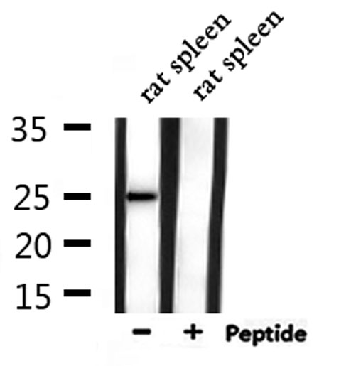 CACNG1 / CACNG Antibody - Western blot analysis of extracts of rat spleen using CACNG1 antibody.