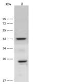 CACNG1 / CACNG Antibody - Anti-CACNG1 rabbit polyclonal antibody at 1:500 dilution. Lane A: Jurkat Whole Cell Lysate. Lysates/proteins at 30 ug per lane. Secondary: Goat Anti-Rabbit IgG (H+L)/HRP at 1/10000 dilution. Developed using the ECL technique. Performed under reducing conditions. Predicted band size: 25 kDa. Observed band size: 25 kDa.