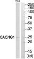 CACNG1 / CACNG Antibody - Western blot analysis of extracts from HeLa cells, using CACNG1 antibody.