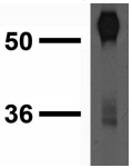CACNG2 + CACNG4 + CACNG8 Antibody - Predicted molecular weight is 35-55kDa.