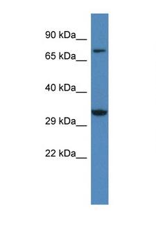 CACNG2 / Stargazin Antibody - CACNG2 / Stargazin antibody Western blot of Rat Liver lysate. Antibody concentration 1 ug/ml.  This image was taken for the unconjugated form of this product. Other forms have not been tested.