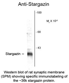 CACNG2 / Stargazin Antibody