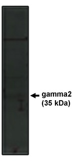 CACNG2 / Stargazin Antibody - Western blot of gamma2 antibody on rat brain lysate.
