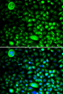 CACNG2 / Stargazin Antibody - Immunofluorescence analysis of HeLa cells.