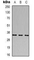 CACNG2 / Stargazin Antibody - Western blot analysis of CACNG2 expression in human brain (A); mouse brain (B); rat brain (C) whole cell lysates.