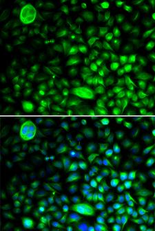 CACNG2 / Stargazin Antibody - Immunofluorescence analysis of HeLa cells using CACNG2 Polyclonal Antibody.
