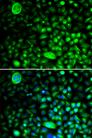 CACNG2 / Stargazin Antibody - Immunofluorescence analysis of HeLa cells using CACNG2 Polyclonal Antibody.