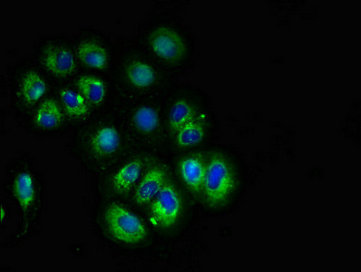 CACNG3 Antibody - Immunofluorescent analysis of A549 cells diluted at 1:100 and Alexa Fluor 488-congugated AffiniPure Goat Anti-Rabbit IgG(H+L)