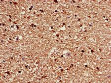 CACNG3 Antibody - Immunohistochemistry of paraffin-embedded human brain tissue at dilution of 1:100