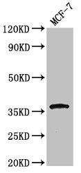 CACNG3 Antibody - Western Blot Positive WB detected in:MCF-7 whole cell lysate All Lanes:CACNG3 antibody at 3.4µg/ml Secondary Goat polyclonal to rabbit IgG at 1/50000 dilution Predicted band size: 36 KDa Observed band size: 36 KDa