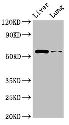 CACNG3 Antibody - Western Blot Positive WB detected in: Rat liver tissue, Rat lung tissue All lanes: CCZ1 antibody at 2.5µg/ml Secondary Goat polyclonal to rabbit IgG at 1/50000 dilution Predicted band size: 56 kDa Observed band size: 56 kDa