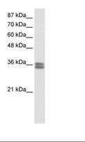CACNG4 Antibody - Jurkat Cell Lysate.  This image was taken for the unconjugated form of this product. Other forms have not been tested.