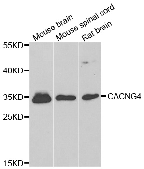 CACNG4 Antibody - Western blot analysis of extracts of various cell lines.