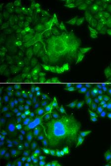 CACNG4 Antibody - Immunofluorescence analysis of A549 cells.