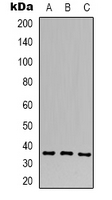 CACNG4 Antibody - Western blot analysis of CACNG4 expression in human brain (A); mouse brain (B); rat brain (C) whole cell lysates.