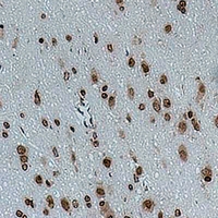 CACNG4 Antibody - Immunohistochemical analysis of CACNG4 staining in rat brain formalin fixed paraffin embedded tissue section. The section was pre-treated using heat mediated antigen retrieval with sodium citrate buffer (pH 6.0). The section was then incubated with the antibody at room temperature and detected using an HRP conjugated compact polymer system. DAB was used as the chromogen. The section was then counterstained with hematoxylin and mounted with DPX.