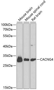 CACNG4 Antibody - Western blot analysis of extracts of various cell lines using CACNG4 Polyclonal Antibody at dilution of 1:1000.