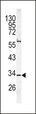 CACNG5 Antibody - Western blot of CACNG5 antibody in K562 cell line lysates (35 ug/lane). CACNG5 (arrow) was detected using the purified antibody.