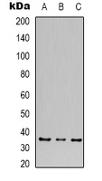 CACNG5 Antibody - Western blot analysis of CACNG5 expression in human brain (A); mouse brain (B); rat brain (C) whole cell lysates.