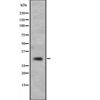 CACNG5 Antibody - Western blot analysis of CACNG5 expression in K562 cells lysate. The lane on the left is treated with the antigen-specific peptide.