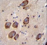 CACNG6 Antibody - CACNG6 Antibody immunohistochemistry of formalin-fixed and paraffin-embedded human brain tissue followed by peroxidase-conjugated secondary antibody and DAB staining.