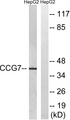 CACNG7 Antibody - Western blot analysis of lysates from HepG2 cells, using CACNG7 Antibody. The lane on the right is blocked with the synthesized peptide.