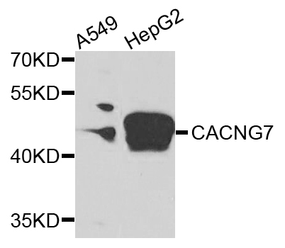 CACNG7 Antibody - Western blot analysis of extracts of various cells.