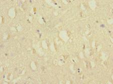 CACNG7 Antibody - Immunohistochemistry of paraffin-embedded human brain tissue at dilution 1:100